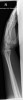 SPORK, NICO - 22.03.1976 - 02.08.2022 - Rö Handgelenk rechts - 16:39:22 - HAND